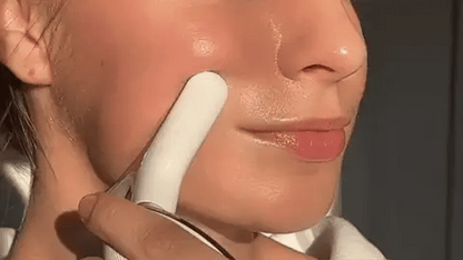 Facial lifting device