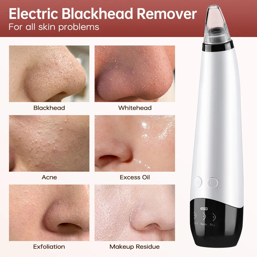 Blackhead Remover